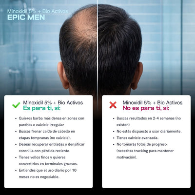 eComm 1 – Minoxidil (5)